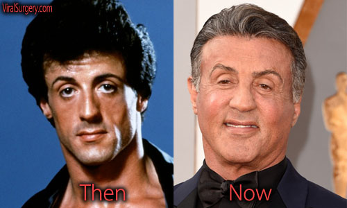 christopher paddock add Sybil Stallone Facial photo