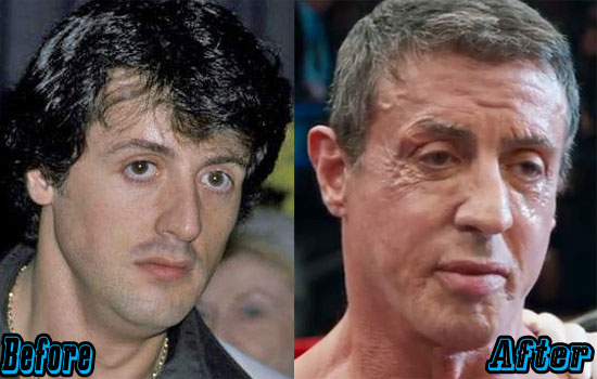 anojan add Sybil Stallone Facial photo