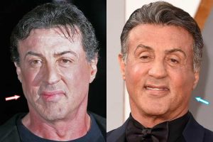 bob noller add Sybil Stallone Facial photo