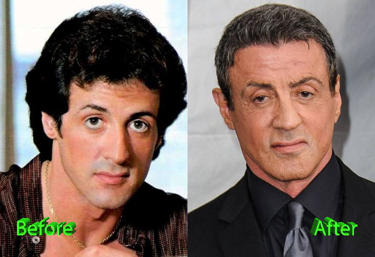 ana dosen add Sybil Stallone Facial photo