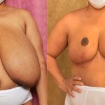 casey roach add Amateur Huge Fake Tits photo