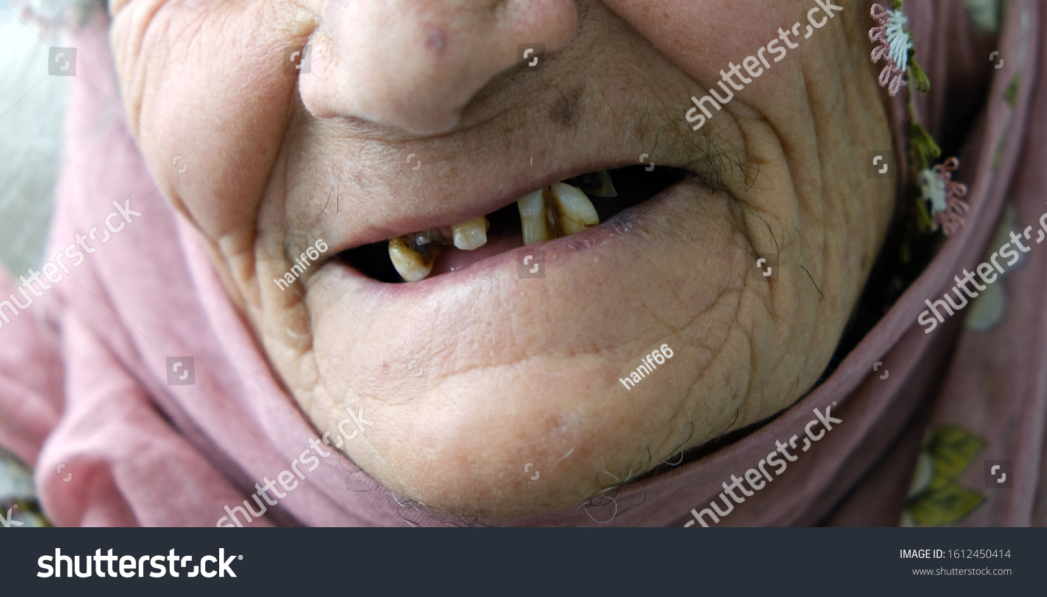 david aspell add No Teeth Old Lady photo