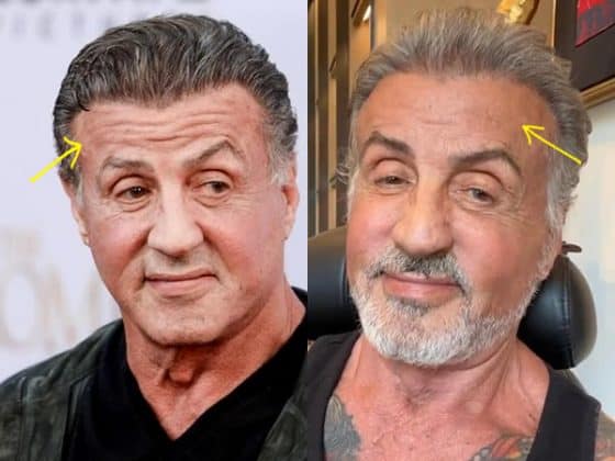 damian marcelo add Sybil Stallone Facial photo