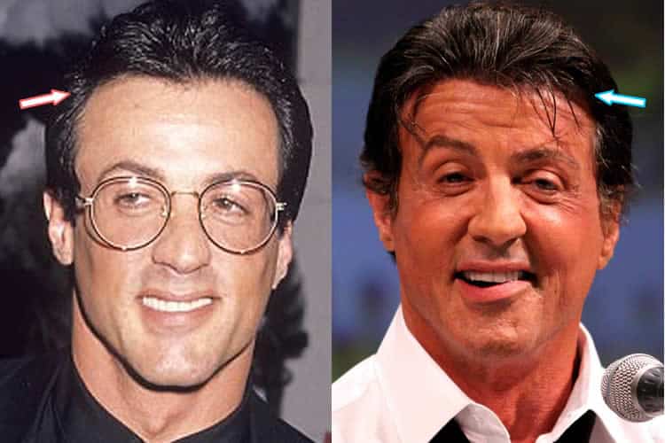 bhaby martinez add Sybil Stallone Facial photo